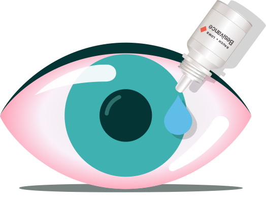 Pink Eye